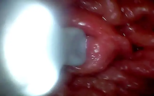 Hotwife Reveals Her Pink Pussy and Big Clit with an Endoscope Close-Up