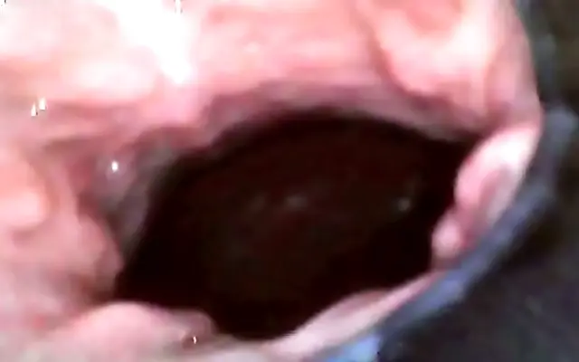 Endoscope Captures Intense Creampie Drip Inside My Pussy